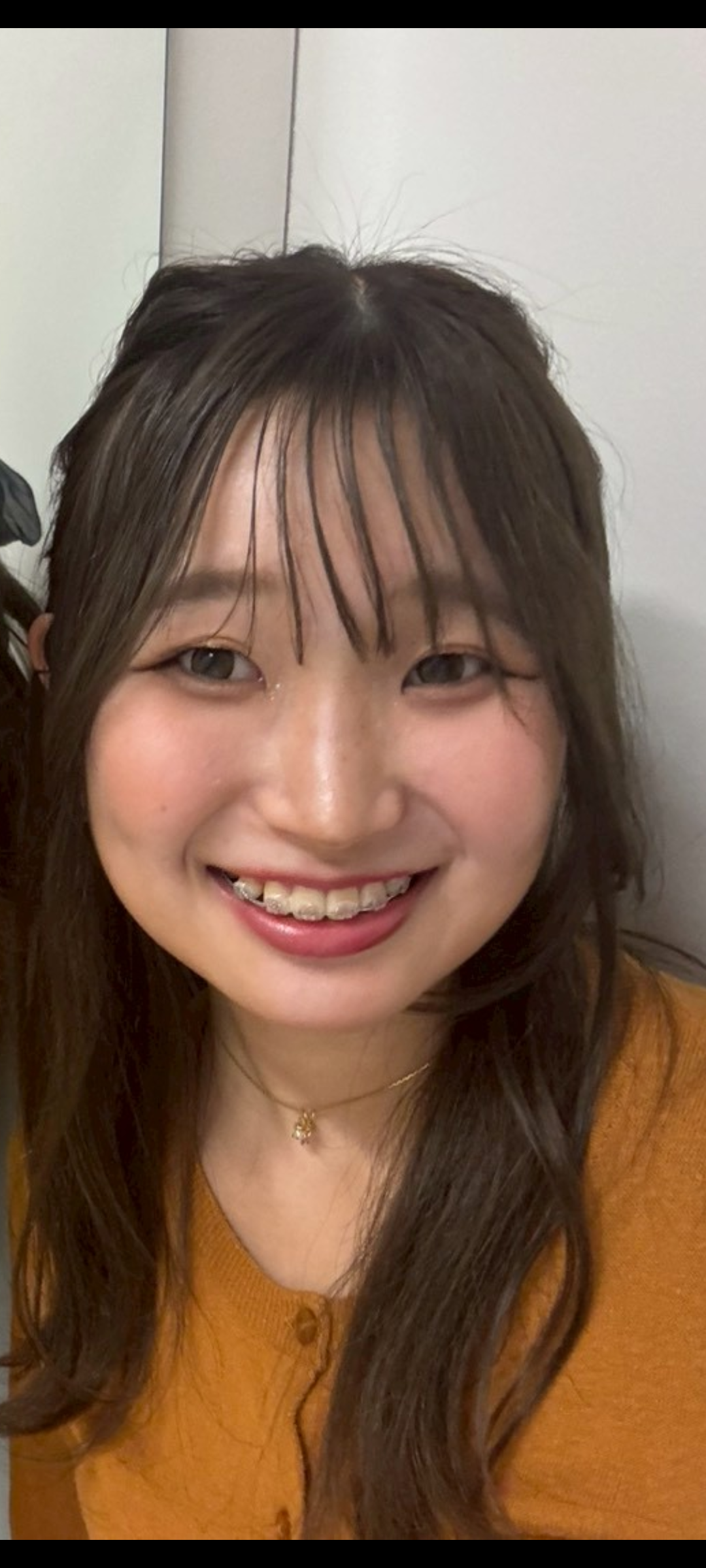 坂元海瑞希の写真